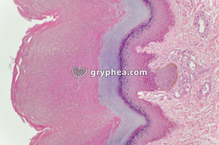 Peau avec glandes sudoripares x40 - gryphea.com